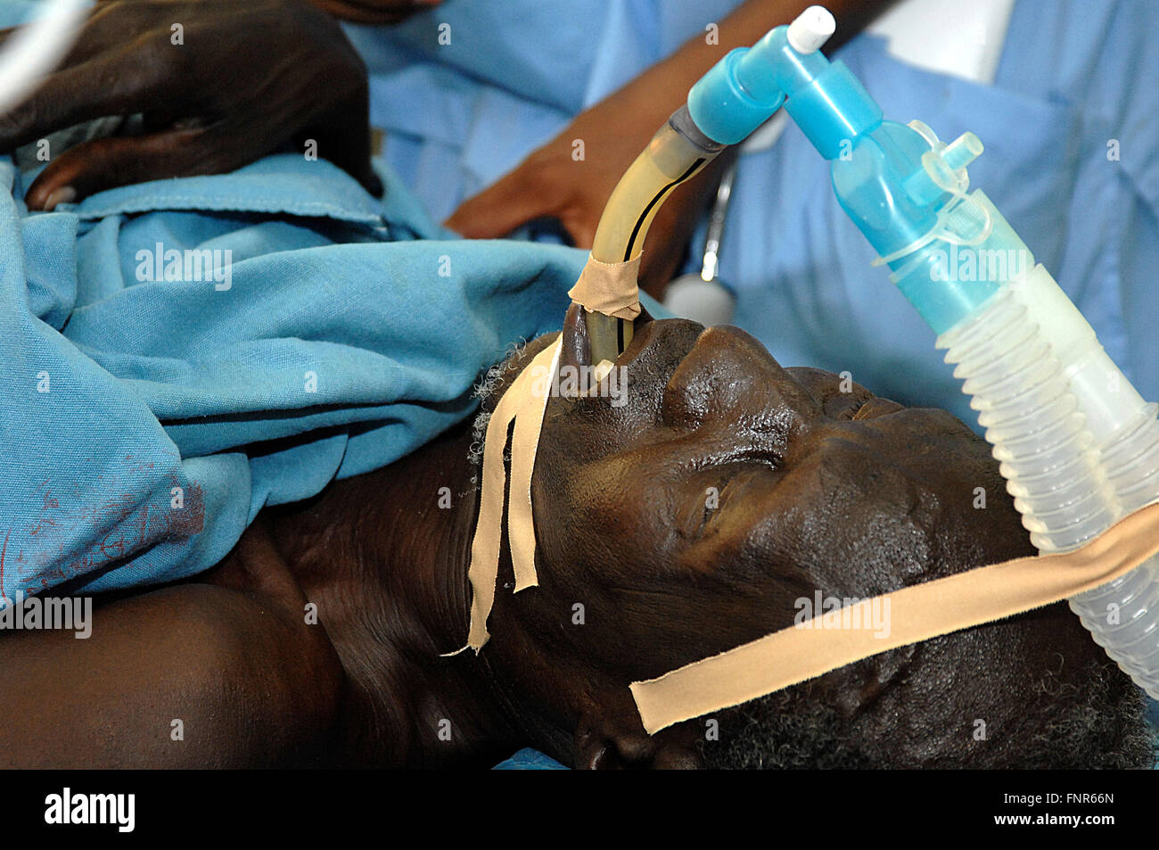 Endotracheal hires stock photography and images Alamy