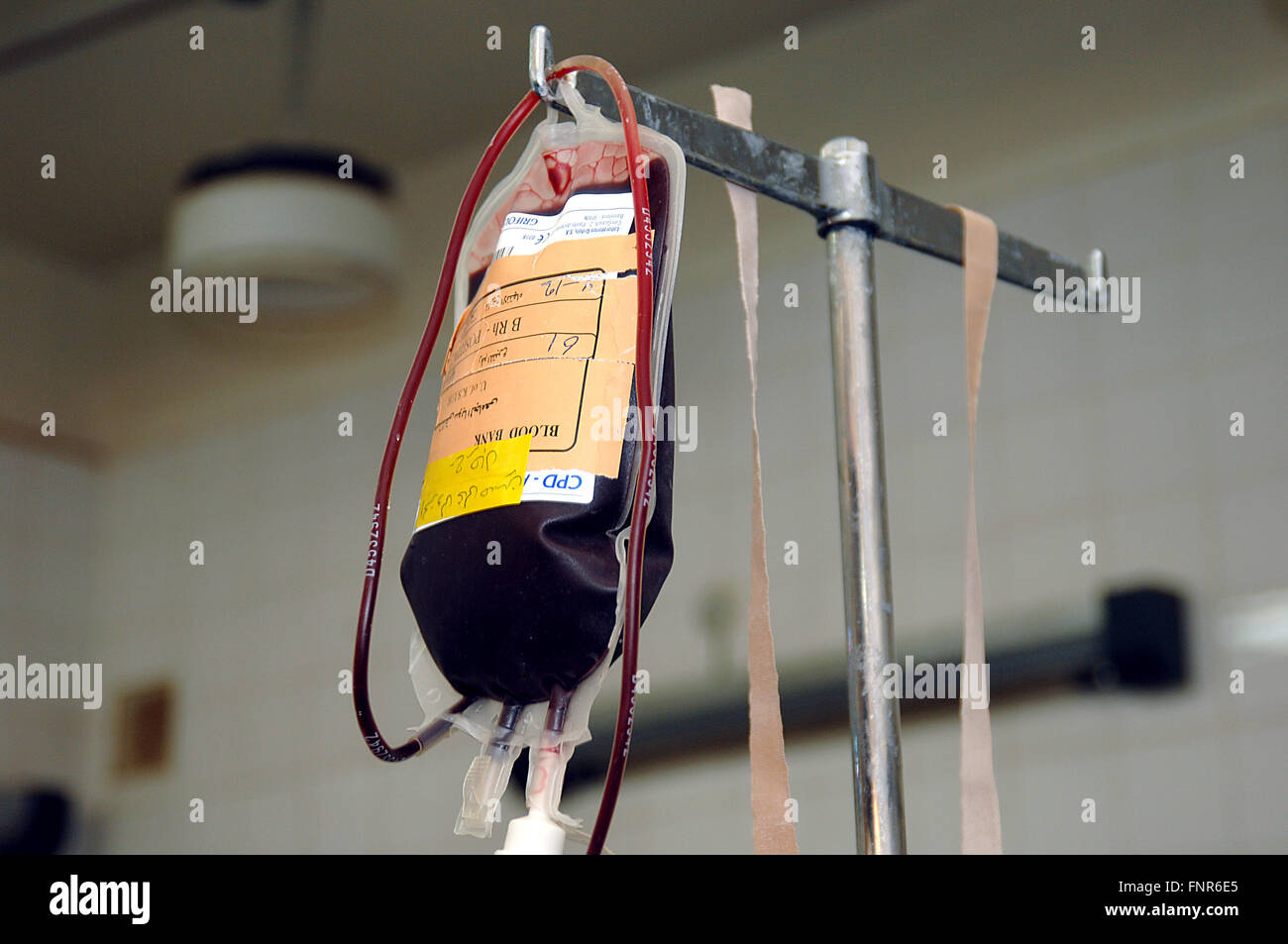 Blood bag hanging from a stand in an operating theatre. Blood bags