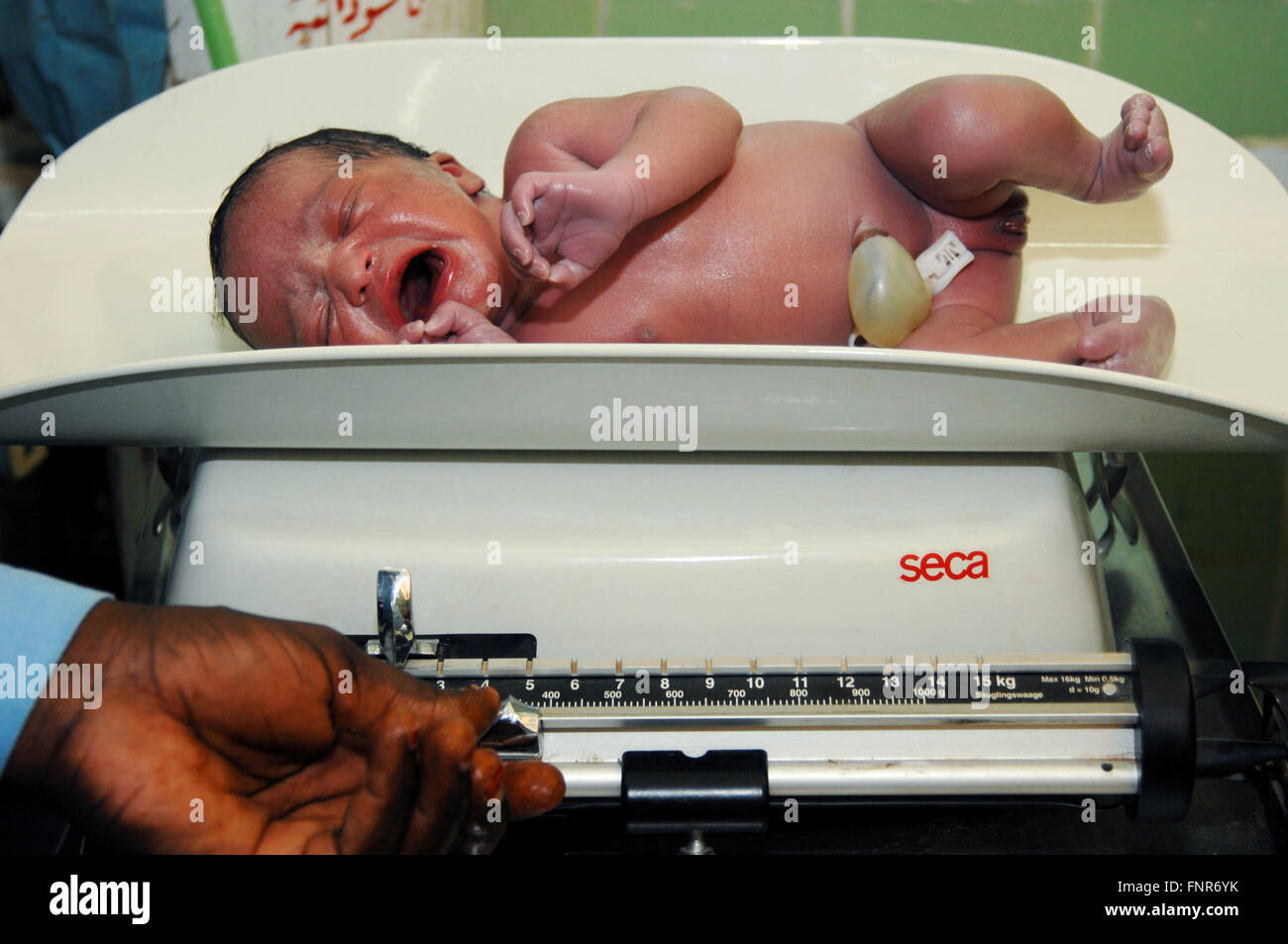New born baby being weighed, soon after birth (umbilical cord still