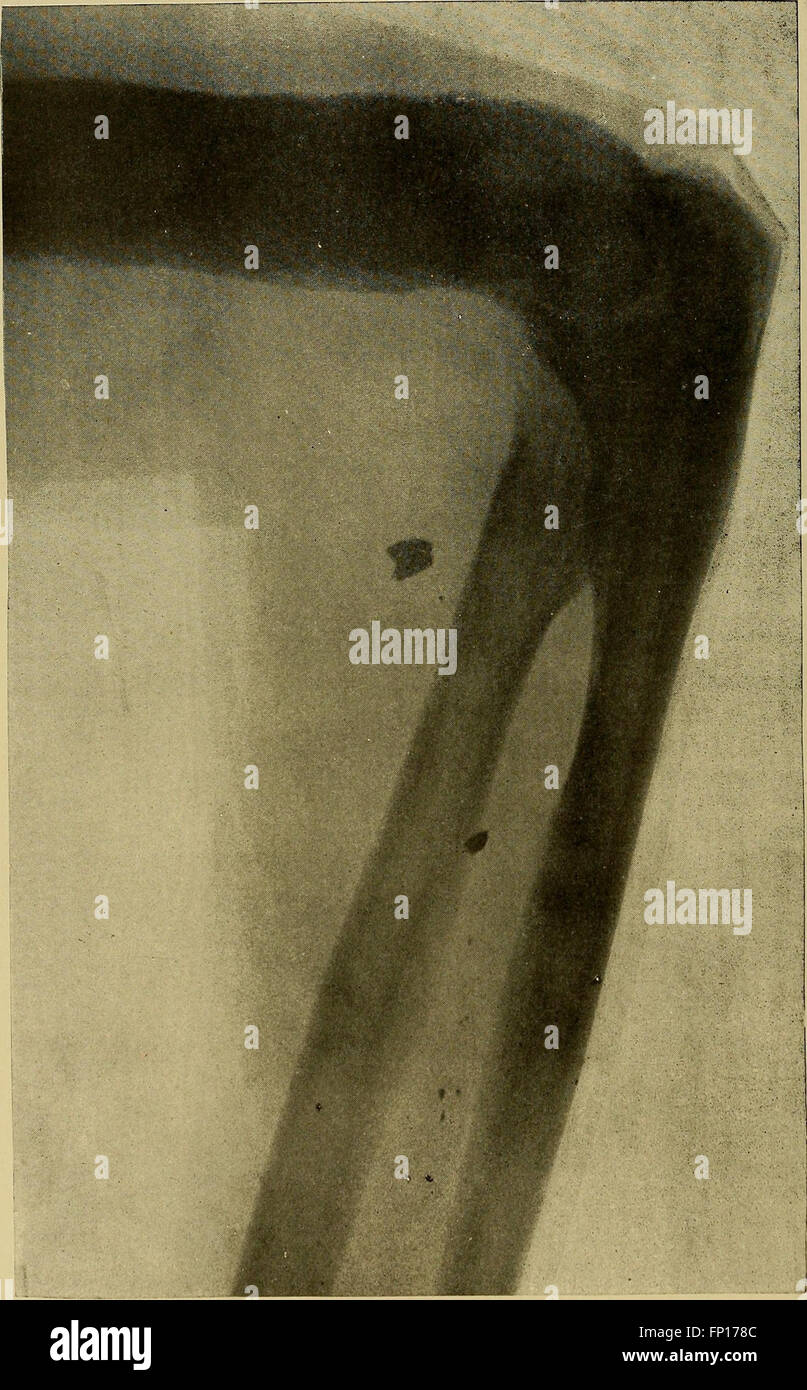This instructional work focuses on X-ray methods, the medical uses of ...