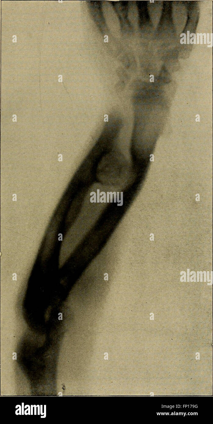 This manual provides a visual and instructional guide on X-ray methods ...