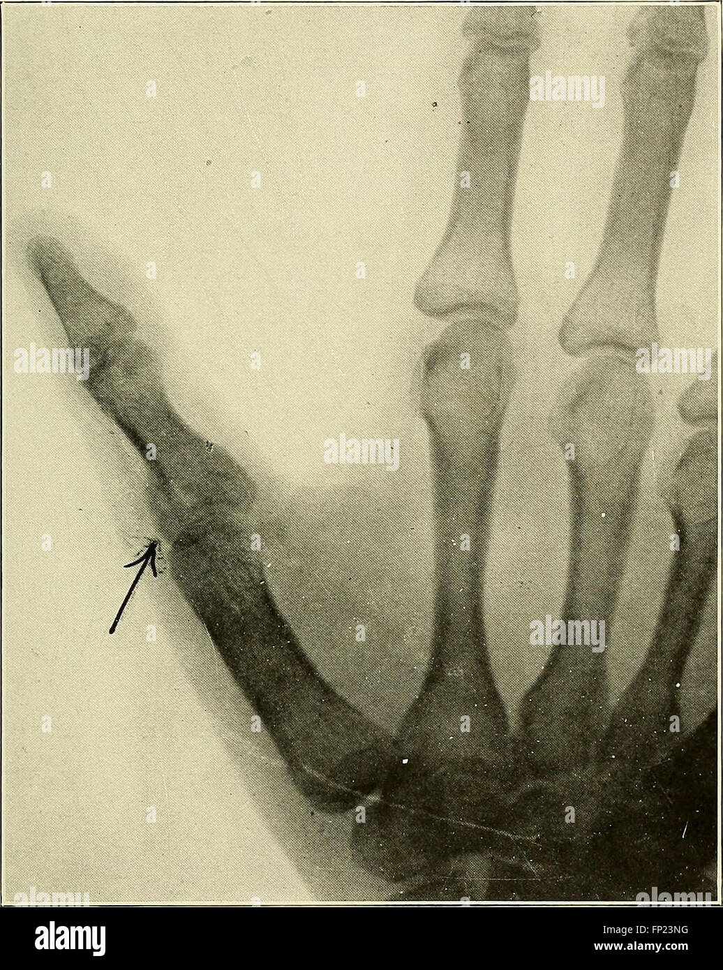 Practical electrotherapeutics and Xray therapy with chapters on phototherapy, Xray in eye