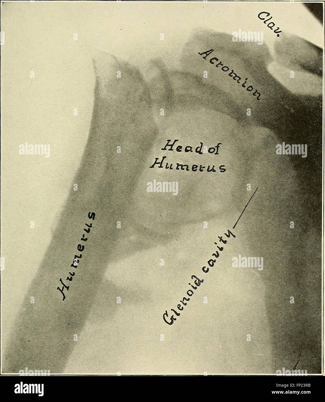 Practical electrotherapeutics and Xray therapy with chapters on phototherapy, Xray in eye