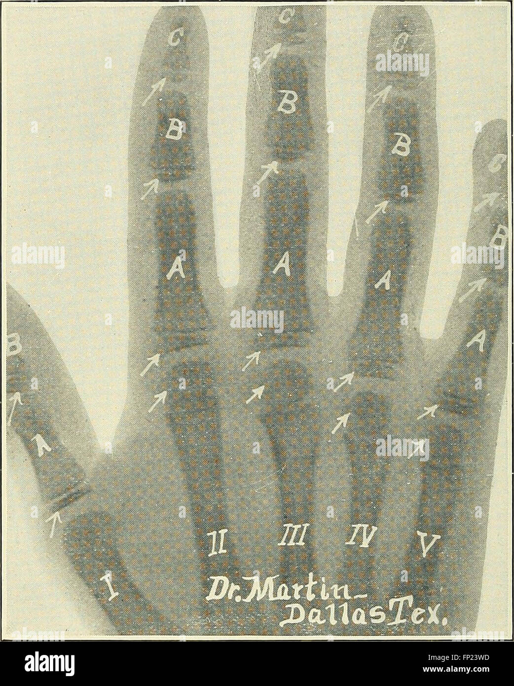 Practical electrotherapeutics and Xray therapy with chapters on phototherapy, Xray in eye