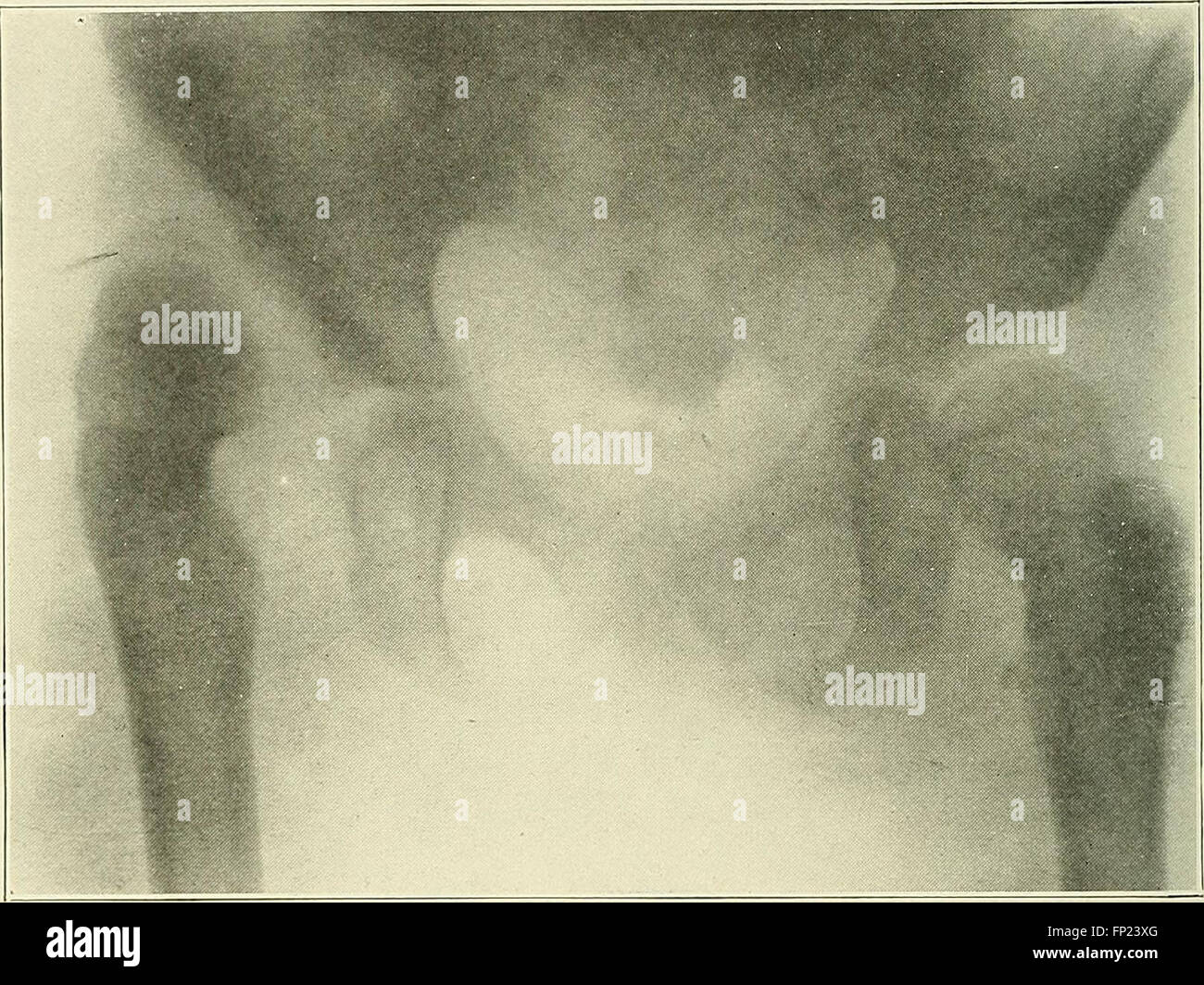 Practical electrotherapeutics and Xray therapy with chapters on phototherapy, Xray in eye