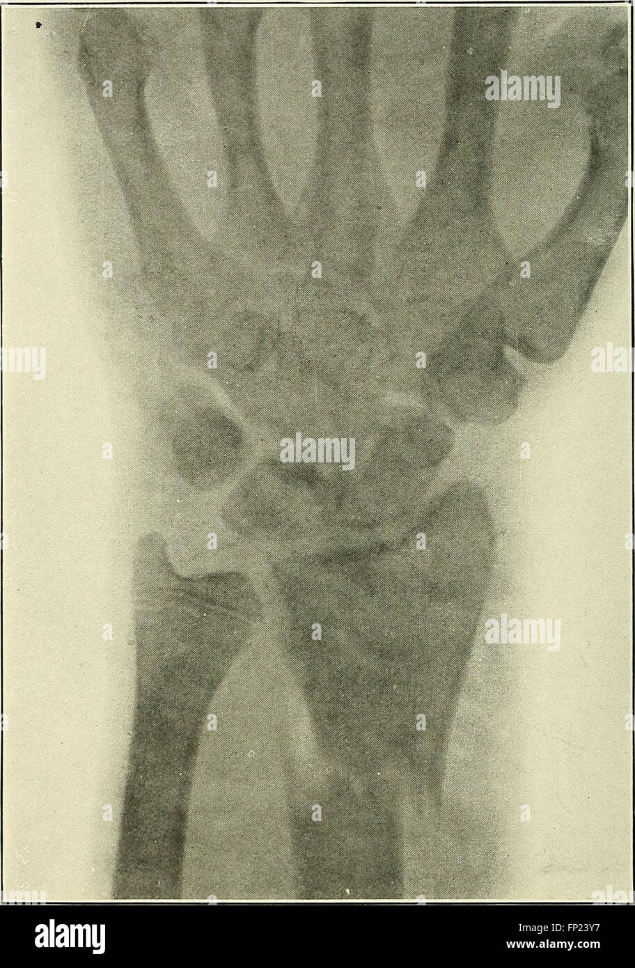 Practical electrotherapeutics and Xray therapy with chapters on phototherapy, Xray in eye