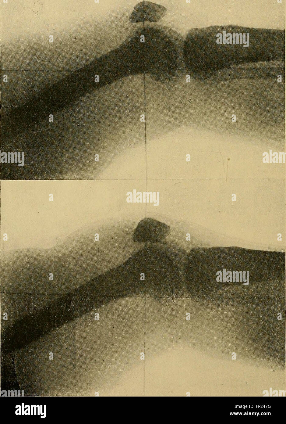 Practical radiography a handbook for physicians, surgeons, and other