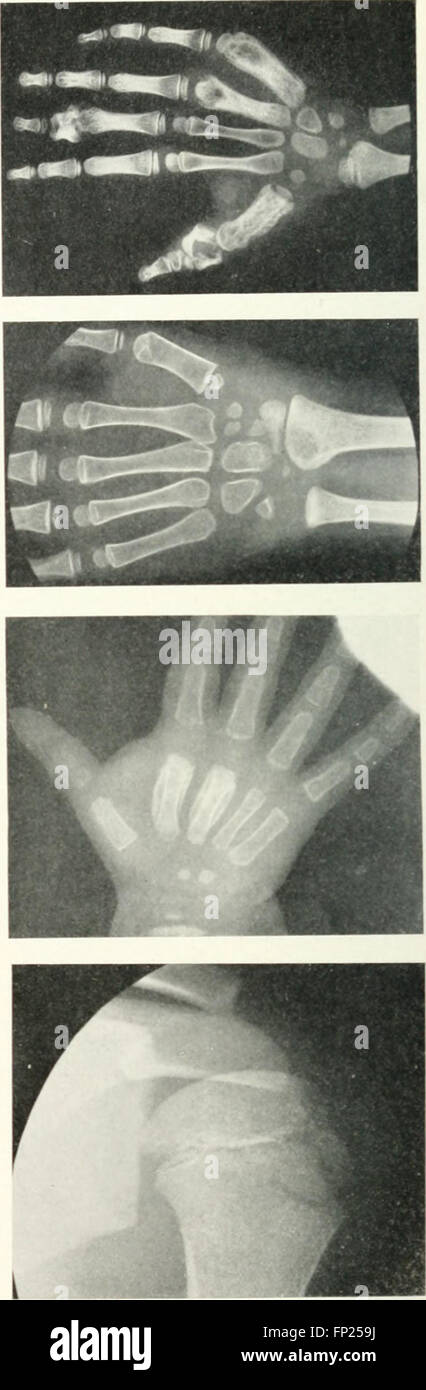 This 1915 work discusses the applications of radiography, X-ray ...