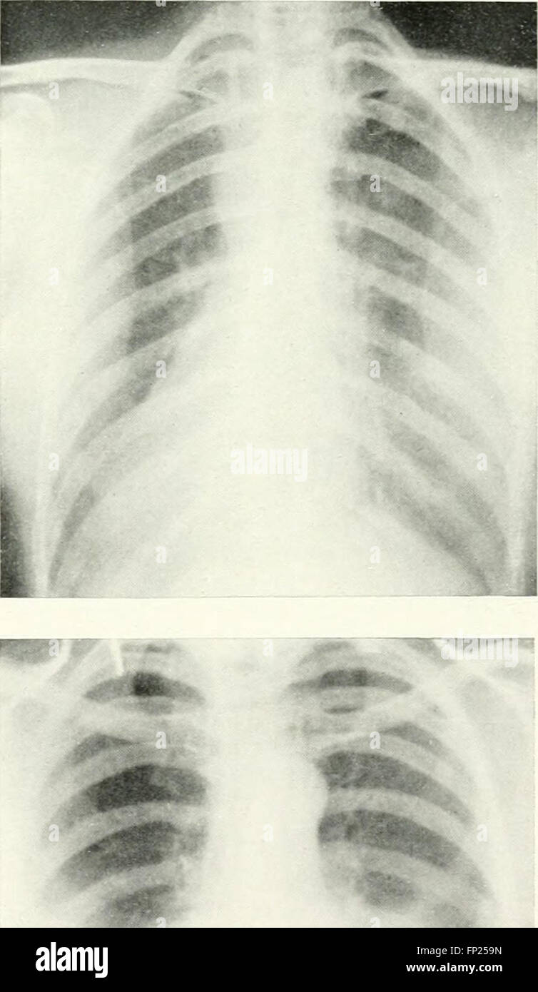 This 1915 publication discusses radiography, x-ray therapy, and radium ...