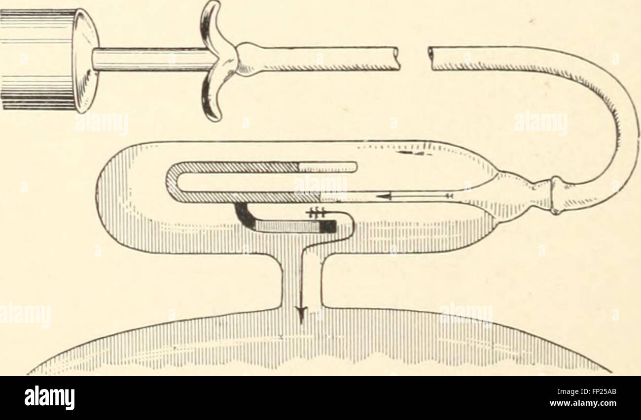 This 1915 publication covers the applications of radiography, X-ray ...