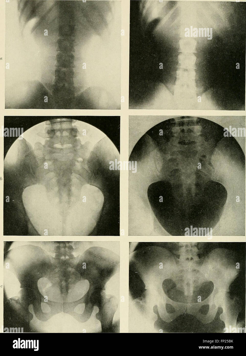Radiography, xray therapeutics and radium therapy (1915 Stock Photo
