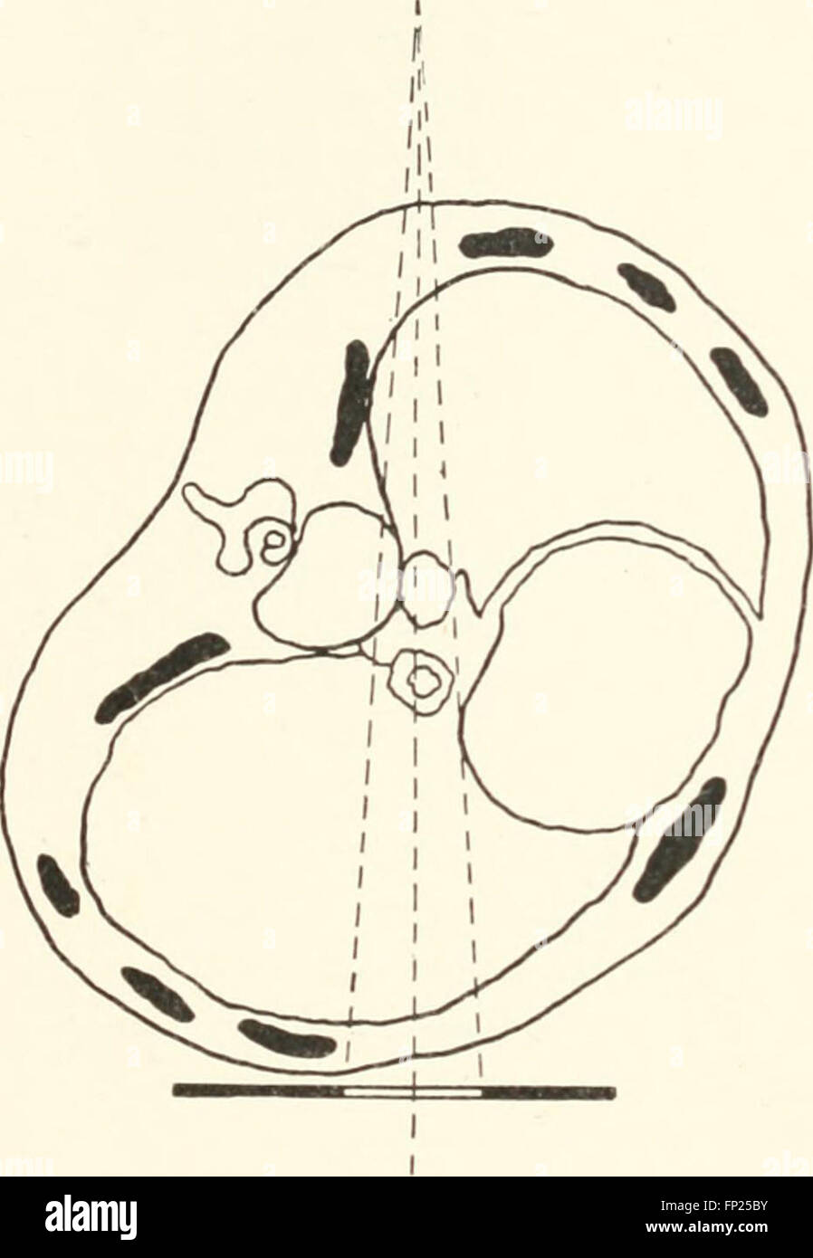 'Radiography, X-ray Therapeutics, and Radium Therapy' (1915) provides a ...