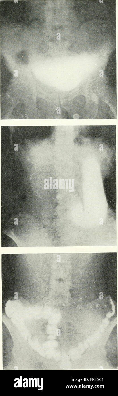 This 1915 work explores the use of radiography, X-ray therapeutics, and ...