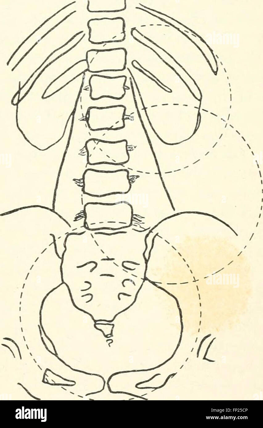 This 1915 work discusses radiography, X-ray therapeutics, and radium ...