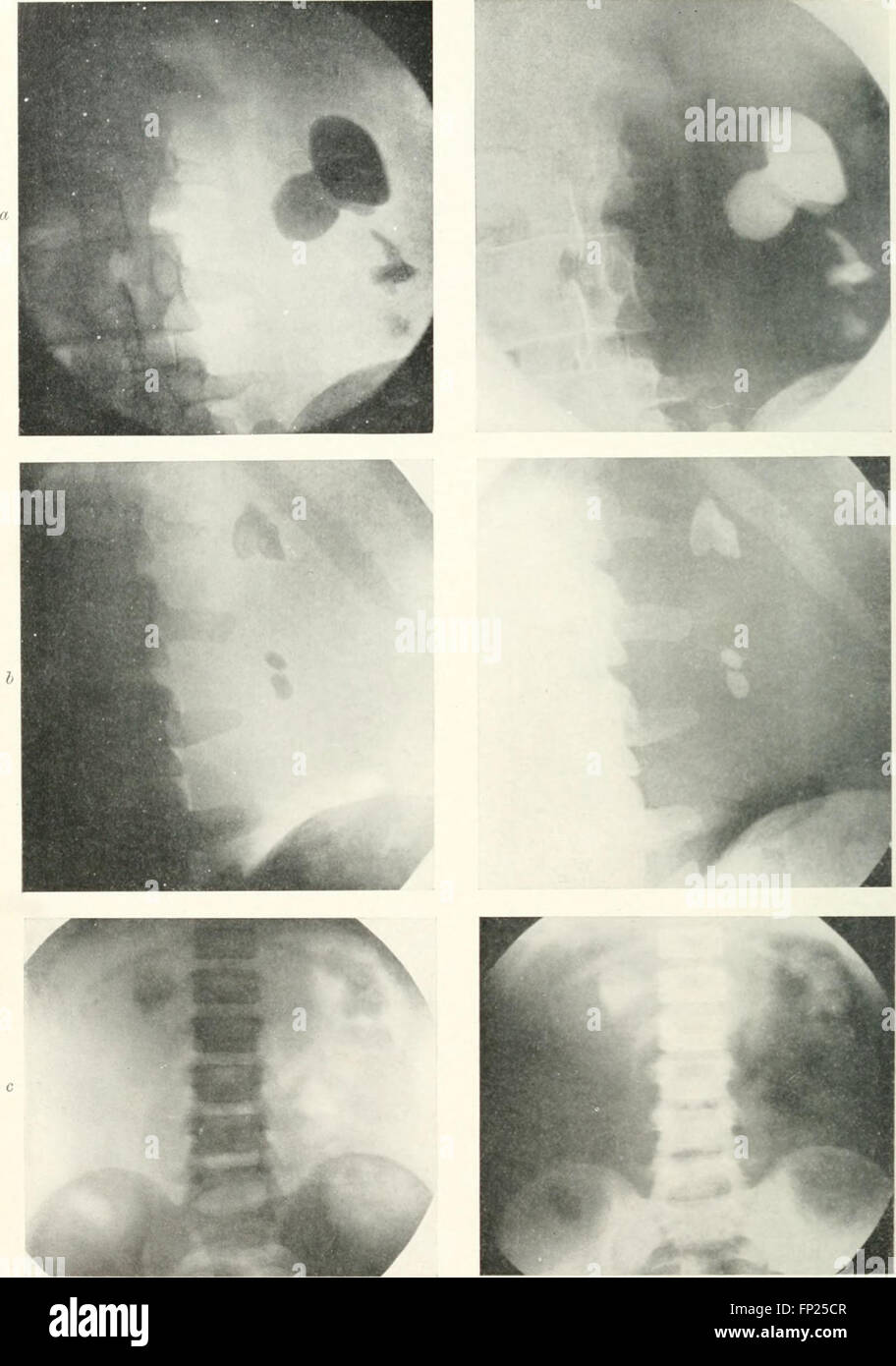 'Radiography, X-ray Therapeutics, and Radium Therapy' (1915) covers the ...