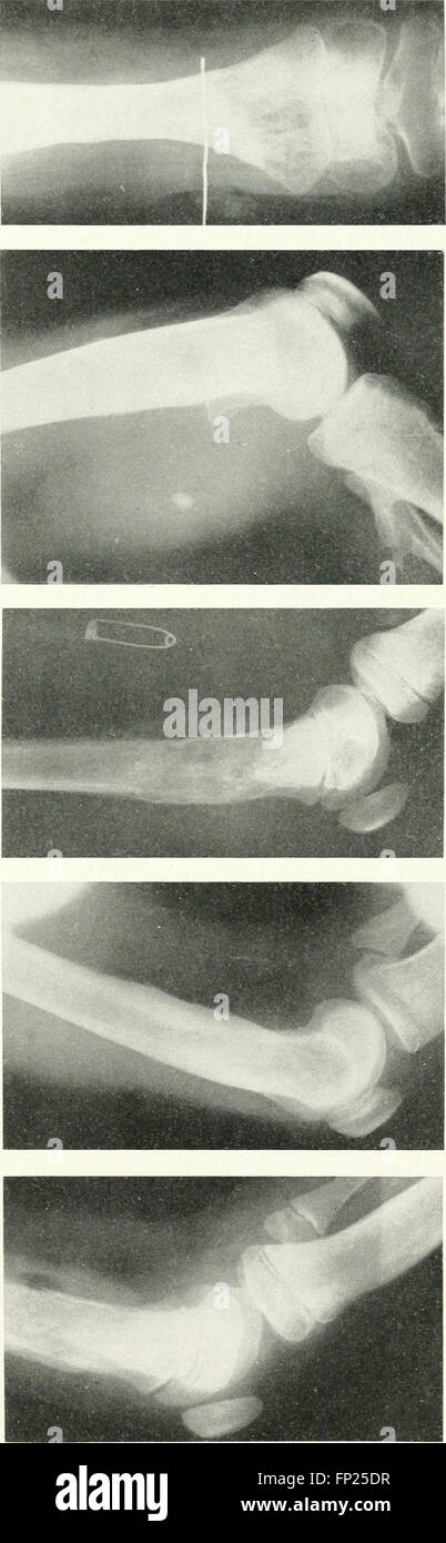 This 1915 work explores the medical applications of radiography, X-ray ...