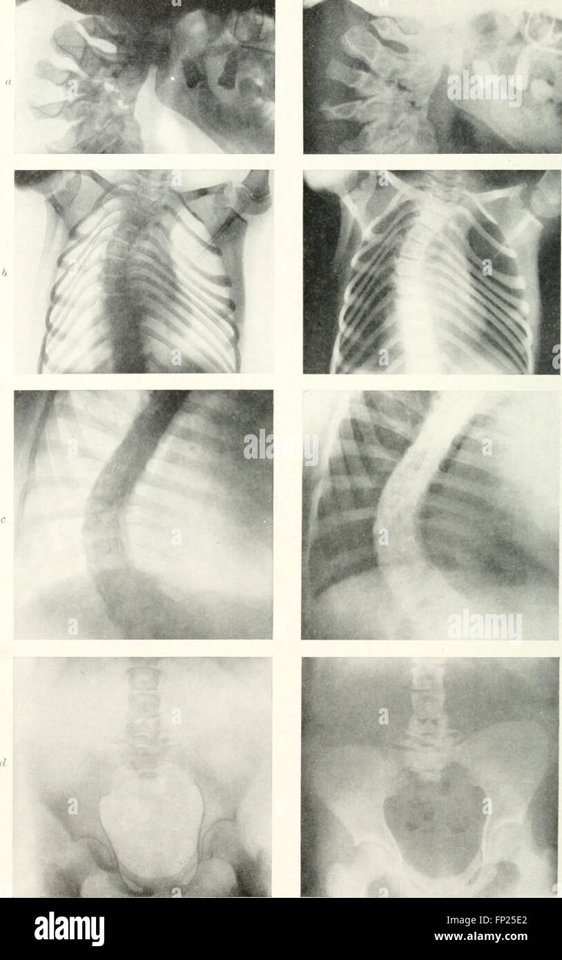'Radiography, X-ray Therapeutics and Radium Therapy' (1915) provides a ...