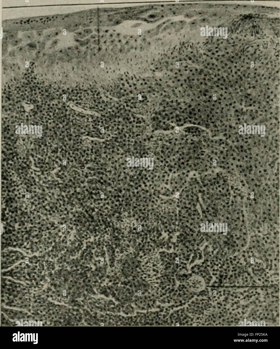 Radium, X rays and the living cell (1915 Stock Photo Alamy