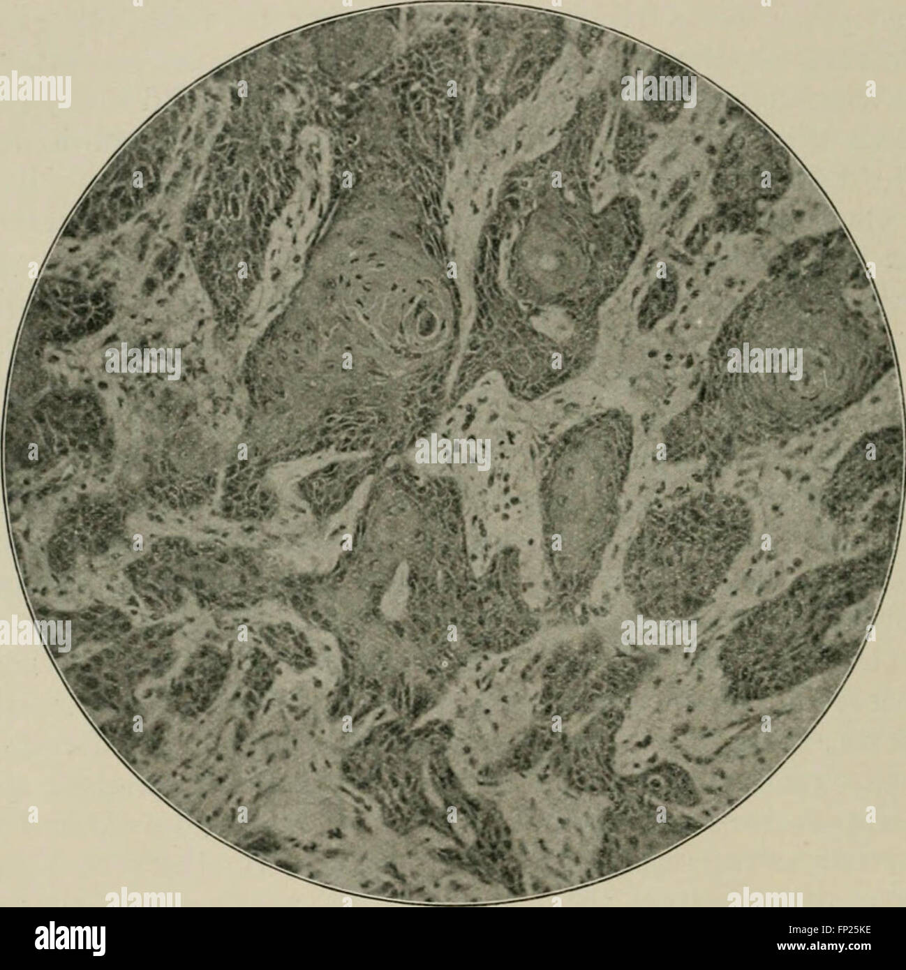 Radium, X rays and the living cell (1915 Stock Photo Alamy