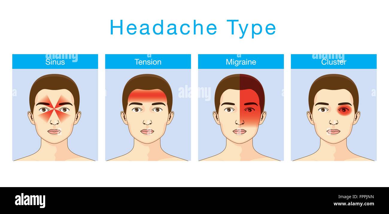 Headache area