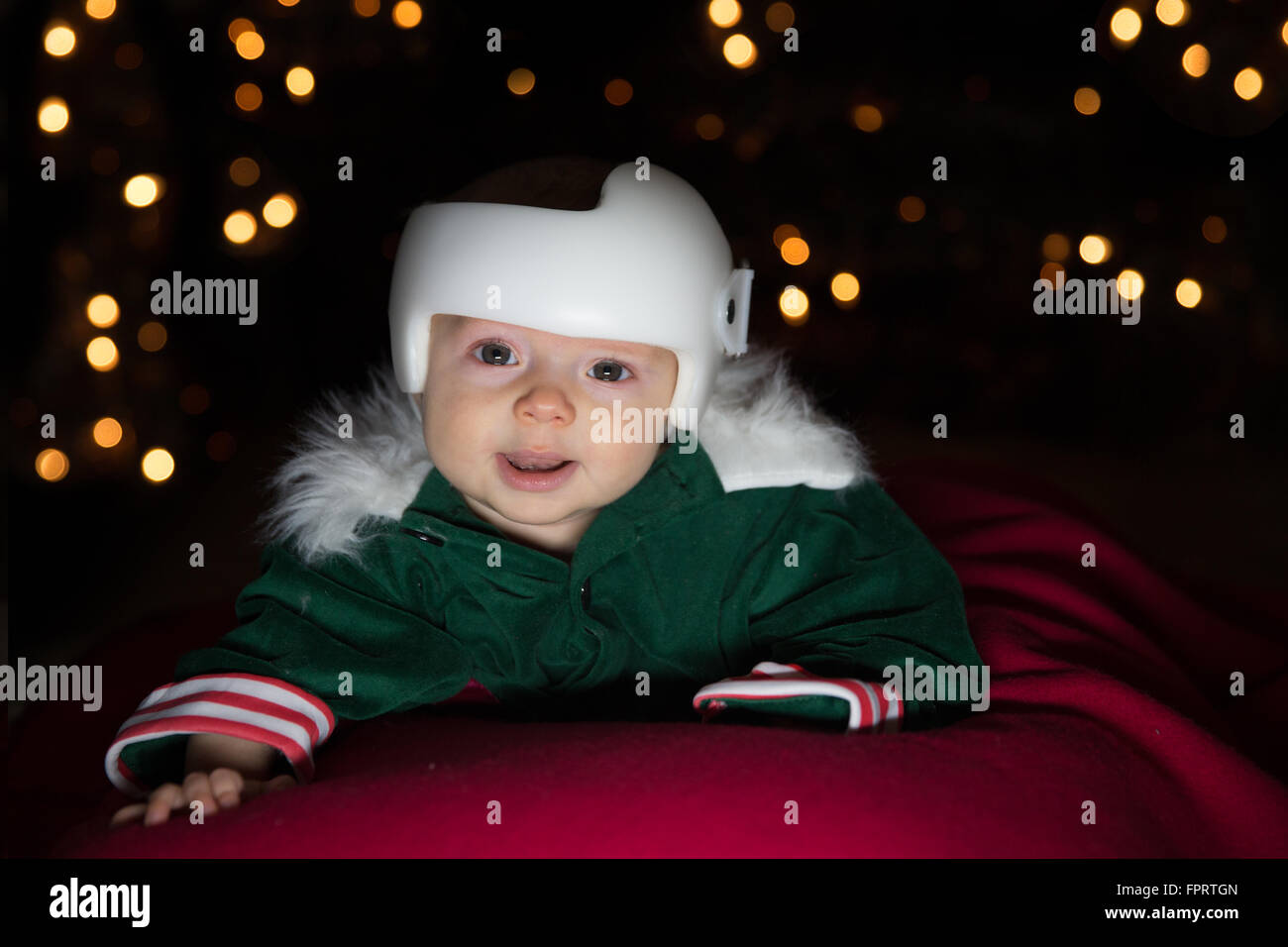 Baby in DOC Band Treatment Stock Photo - Alamy