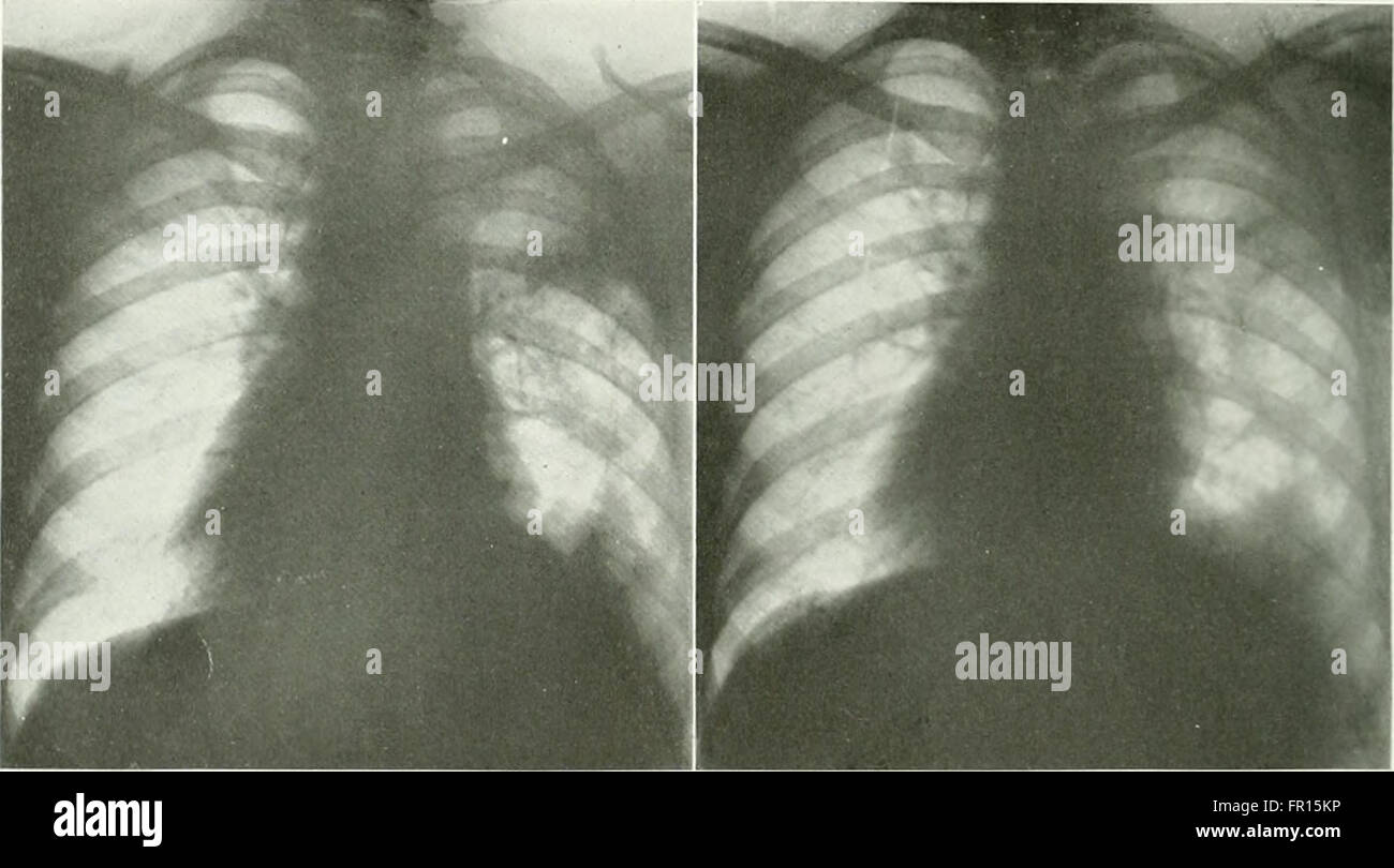 The American journal of roentgenology, radium therapy and nuclear medicine (1906) Stock Photo