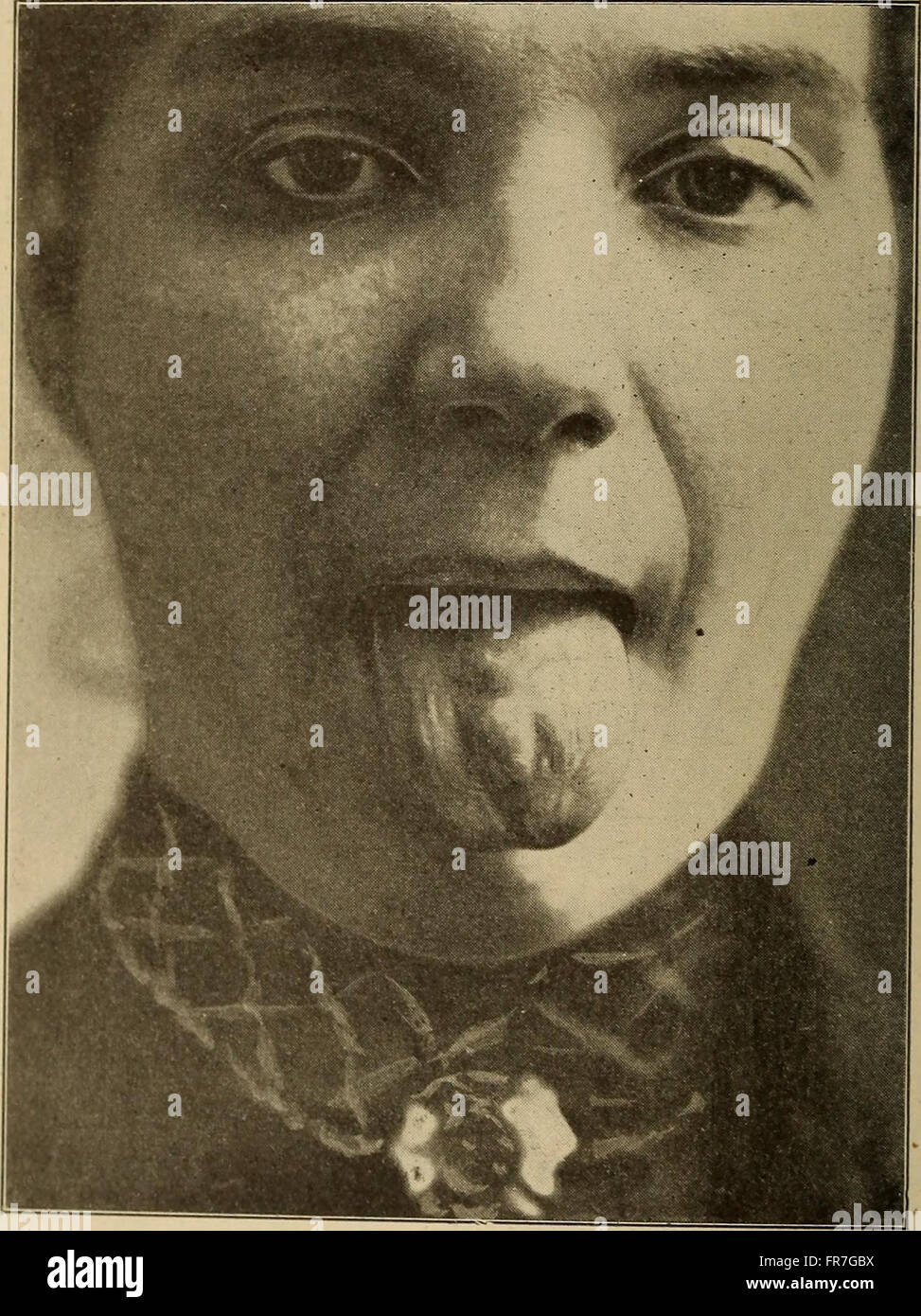 Pathology visual data 5