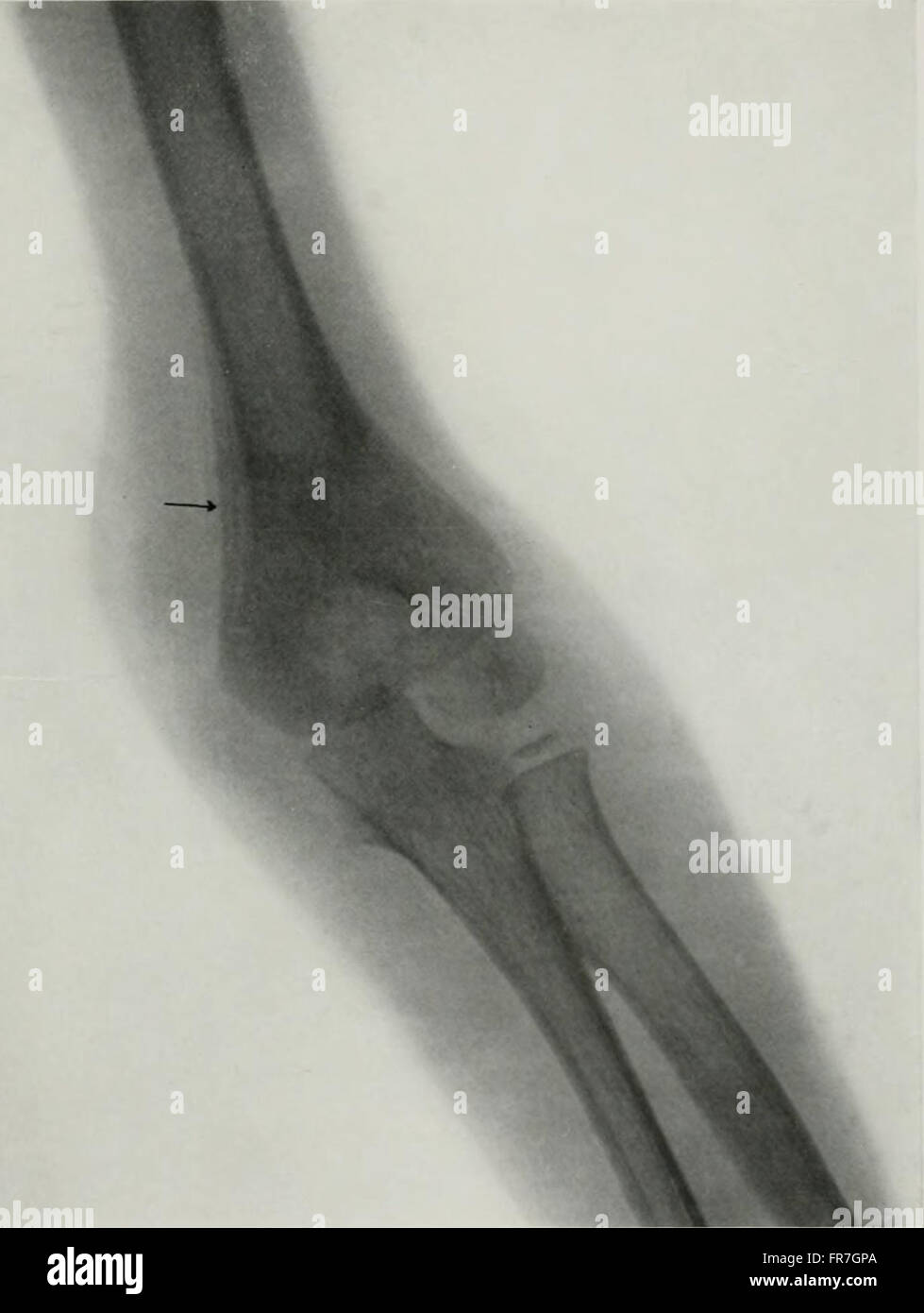 Living anatomy and pathology; the diagnosis of diseases in early life by the Roentgen method (1910) Stock Photo