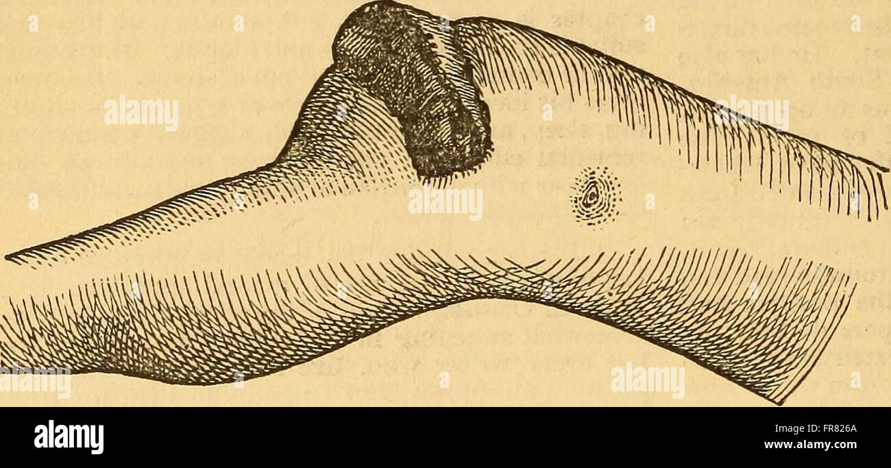 Syphilis Drawing An 1886 medical work outlining the pathology, symptoms, and treatments ...