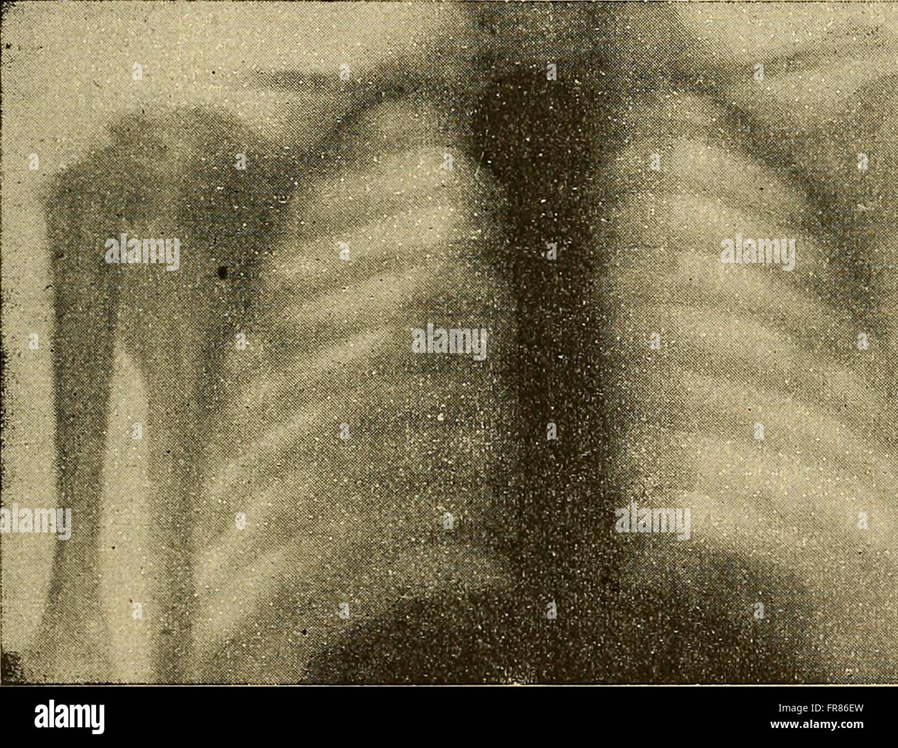This 1897 French textbook focuses on medical and scientific radiography ...