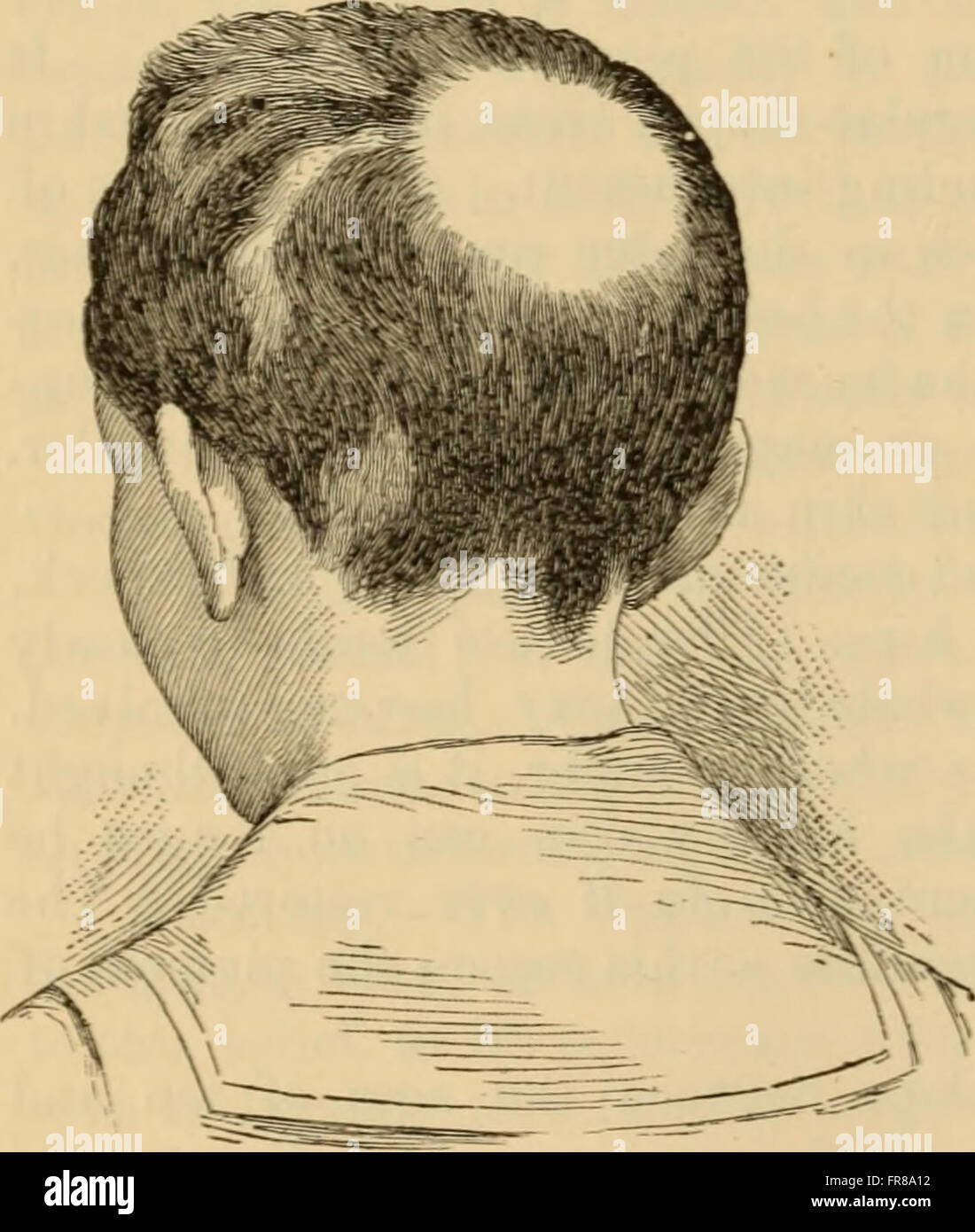 An American text-book of the diseases of children (1895 Stock Photo - Alamy
