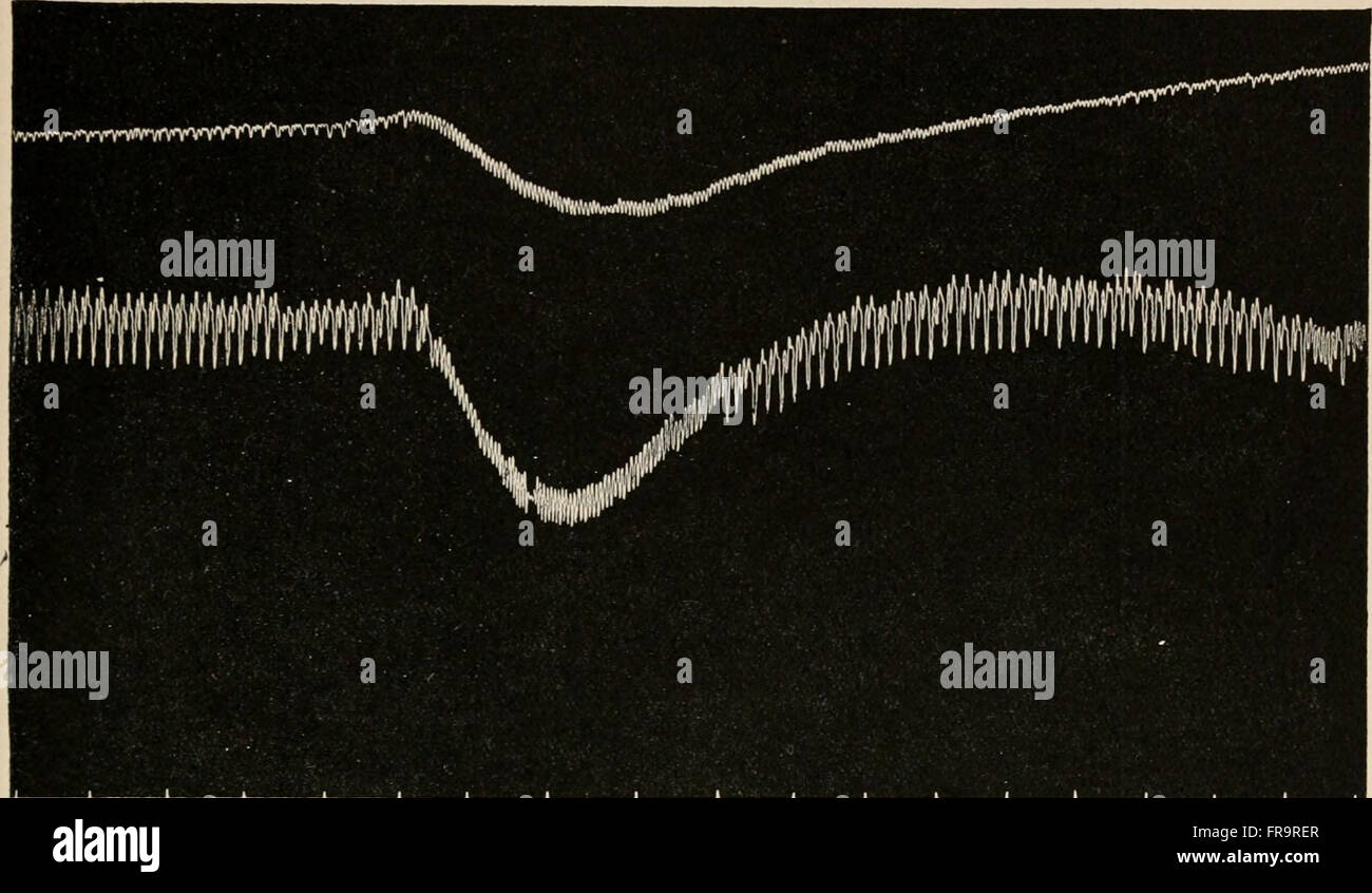 This 1916 text introduces the study of endocrine organs and their role ...