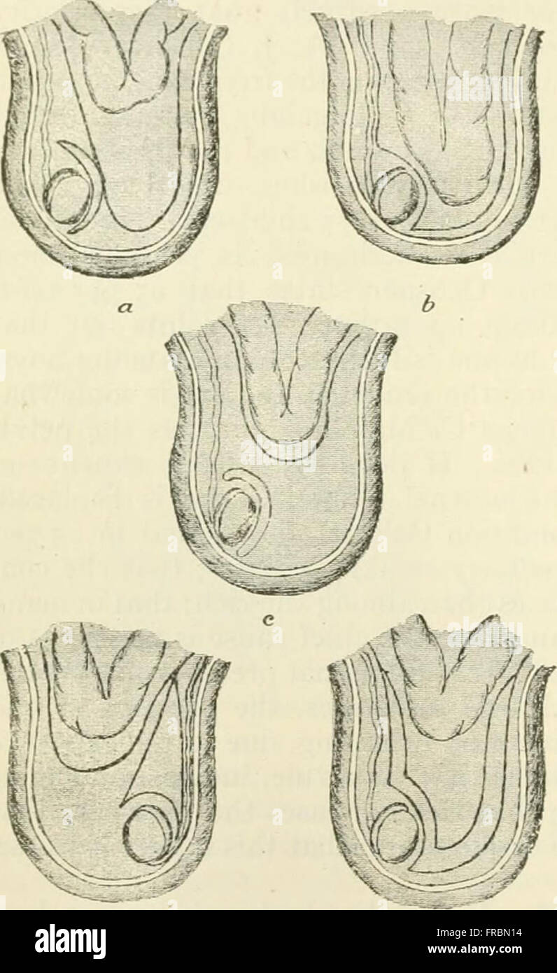 'Modern Surgery, General and Operative' (1919) provides comprehensive ...