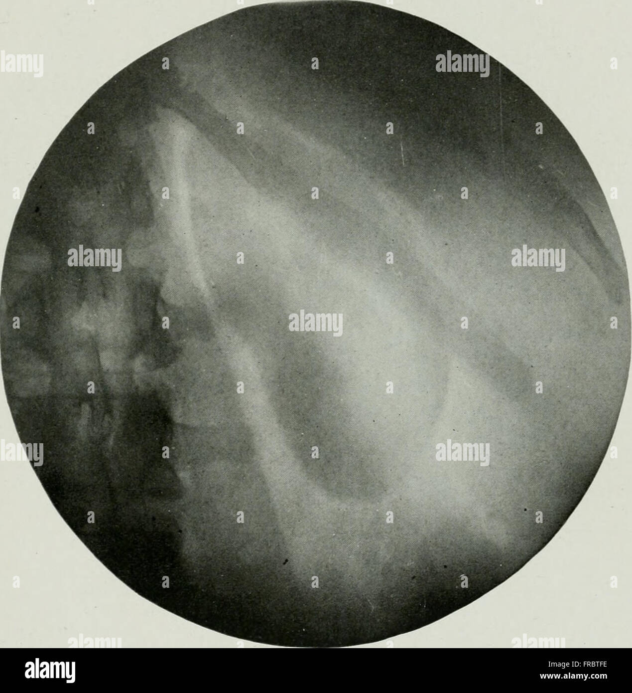 This 1906 journal discusses advancements in roentgenology (X-ray ...