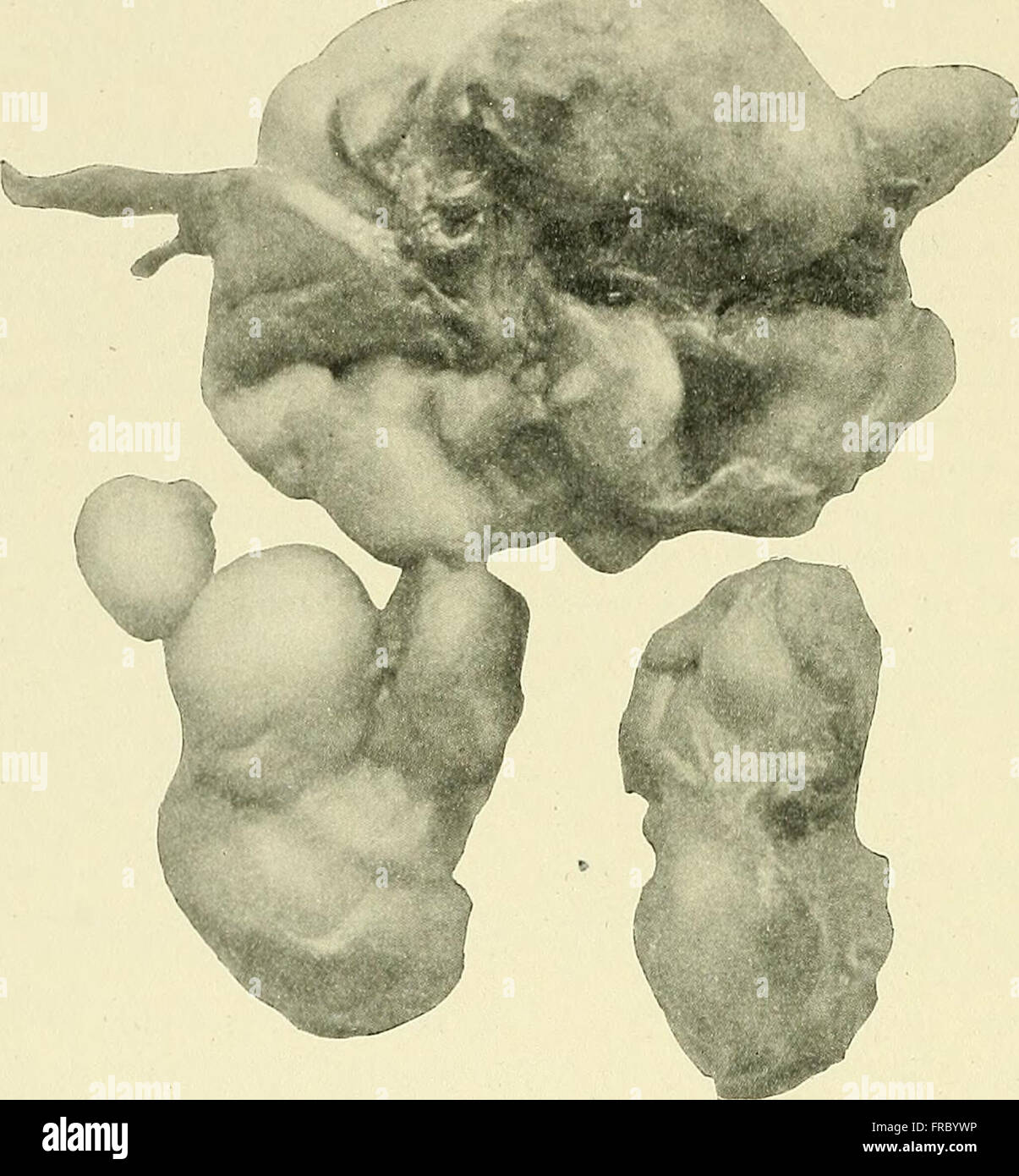 Prostate cancer studies hi-res stock photography and images - Alamy