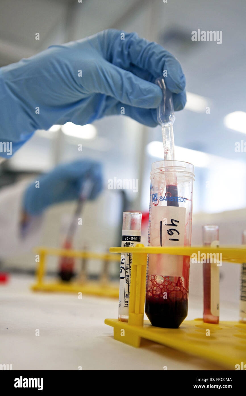 Bone marrow test hi-res stock photography and images - Alamy