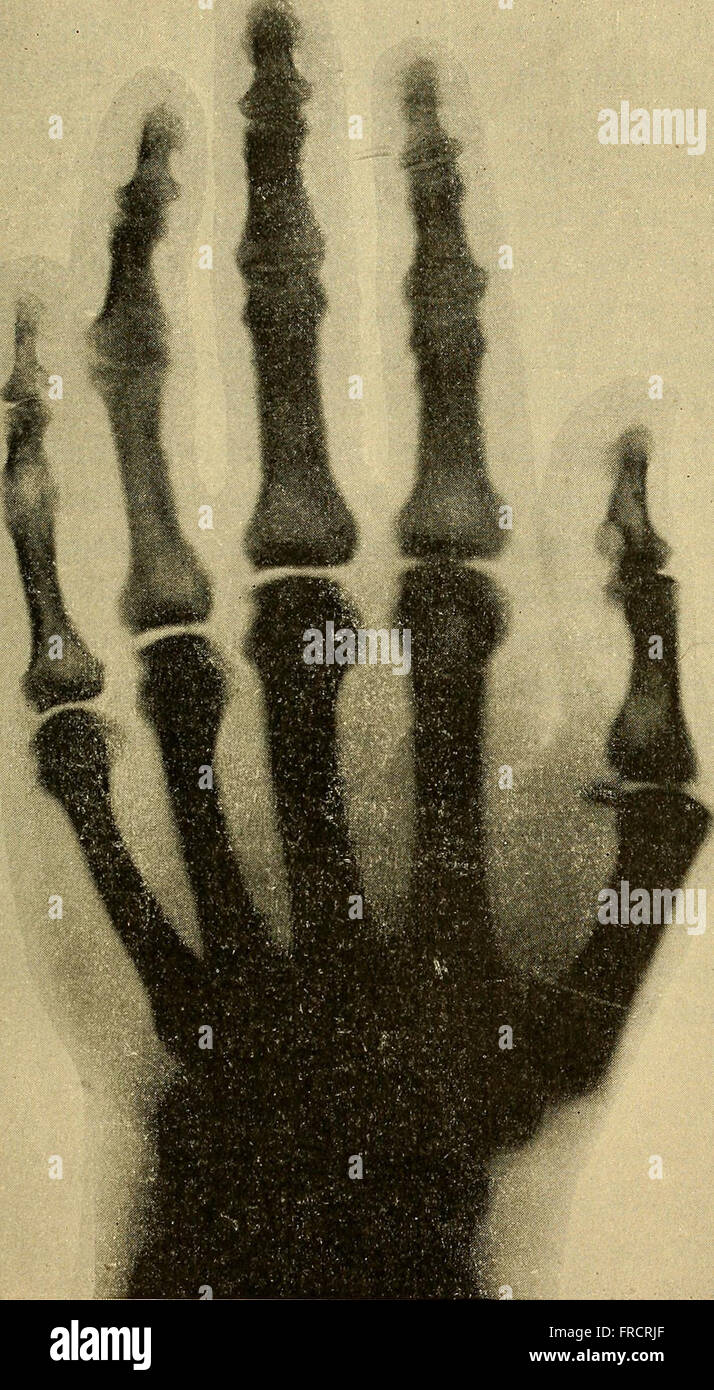 This 1897 treatise, 'Traité de radiographie médicale et scientifique ...