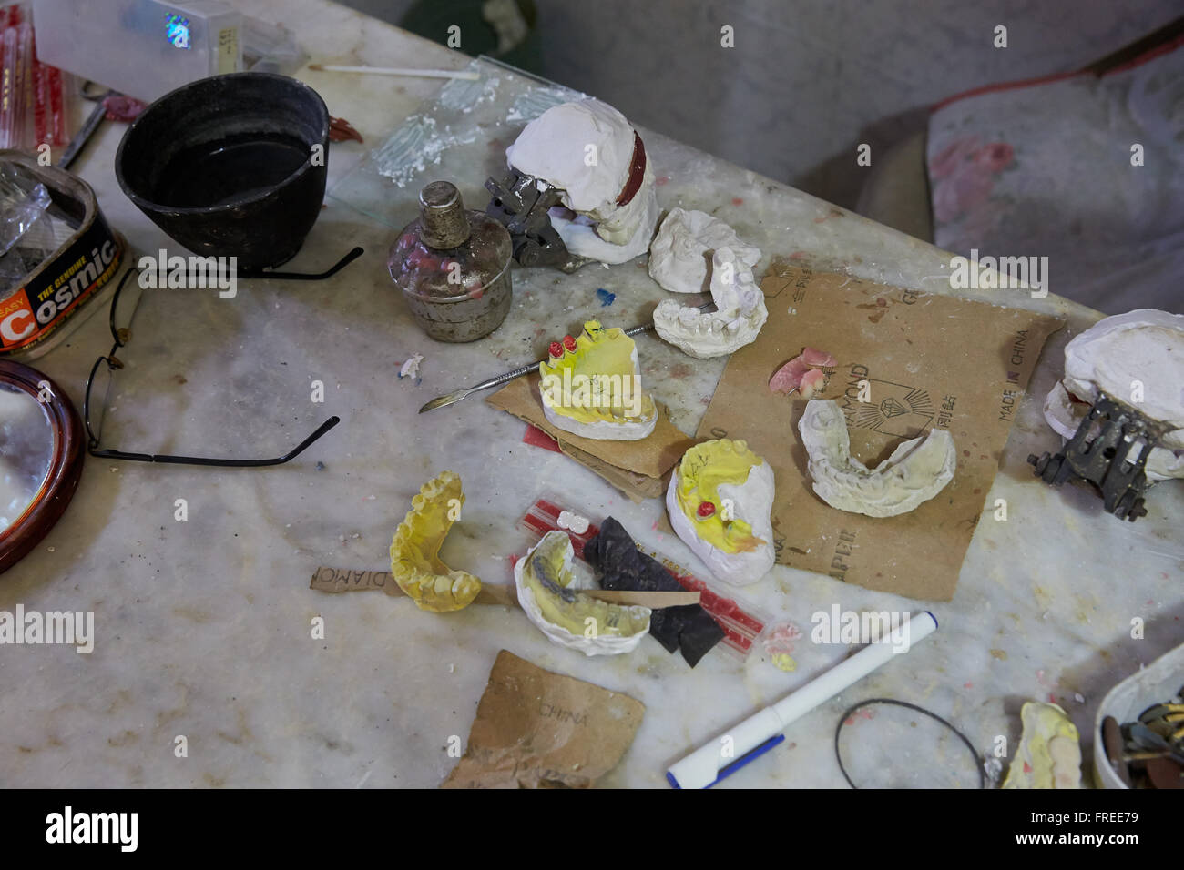 Casts of teeth, dental impression in a dental practice, Rawalpindi, Pakistan Stock Photo