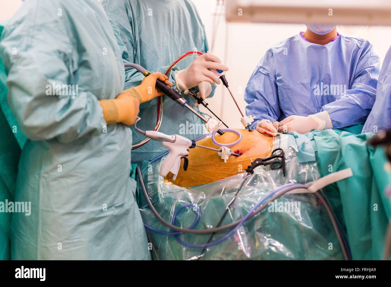 Surgical laparoscopy and hysteroscopy exploration here, treatment of endometriosis. Stock Photo