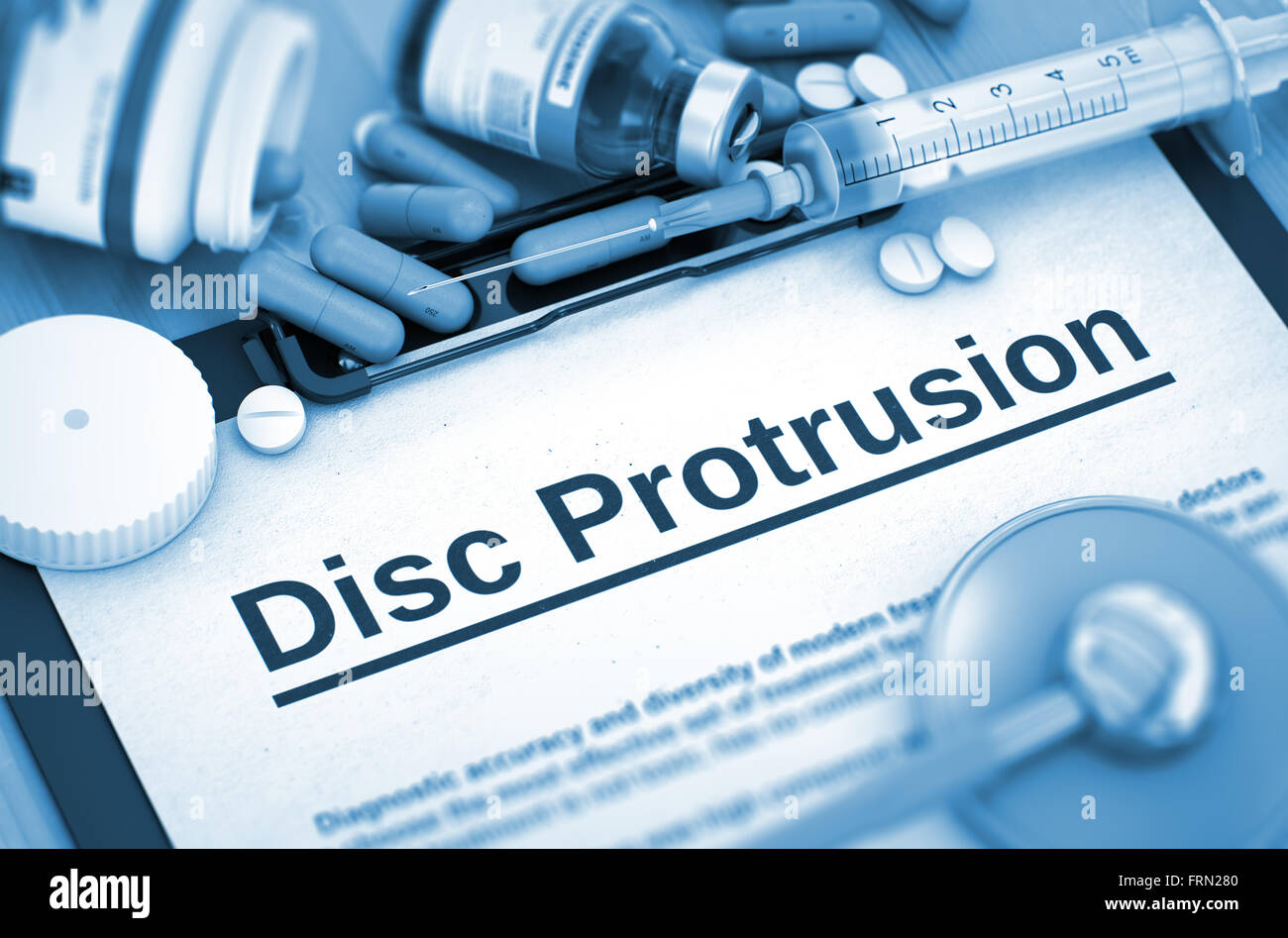 Disc Protrusion. Medical Concept. Stock Photo