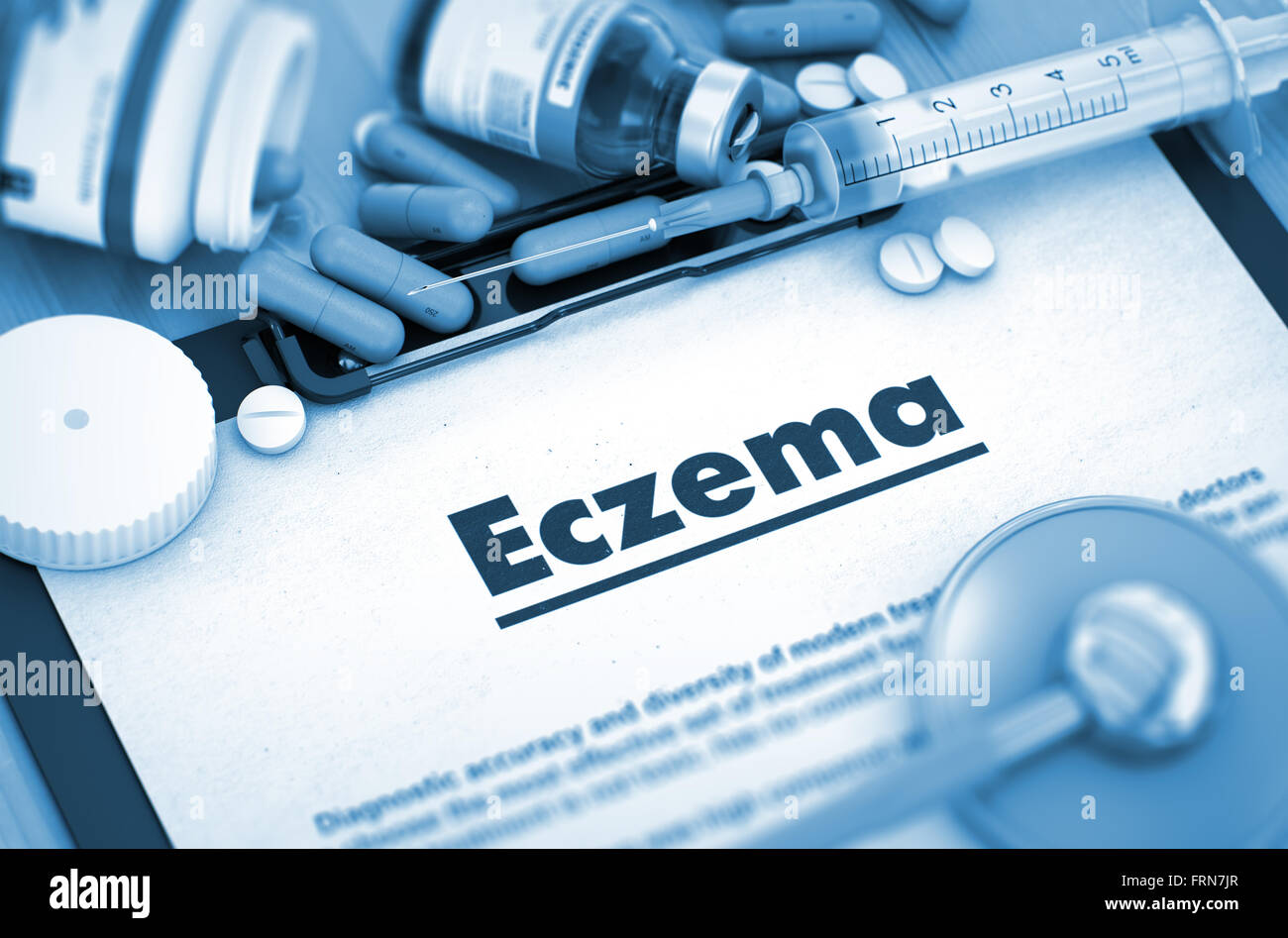 Eczema. Medical Concept. Stock Photo