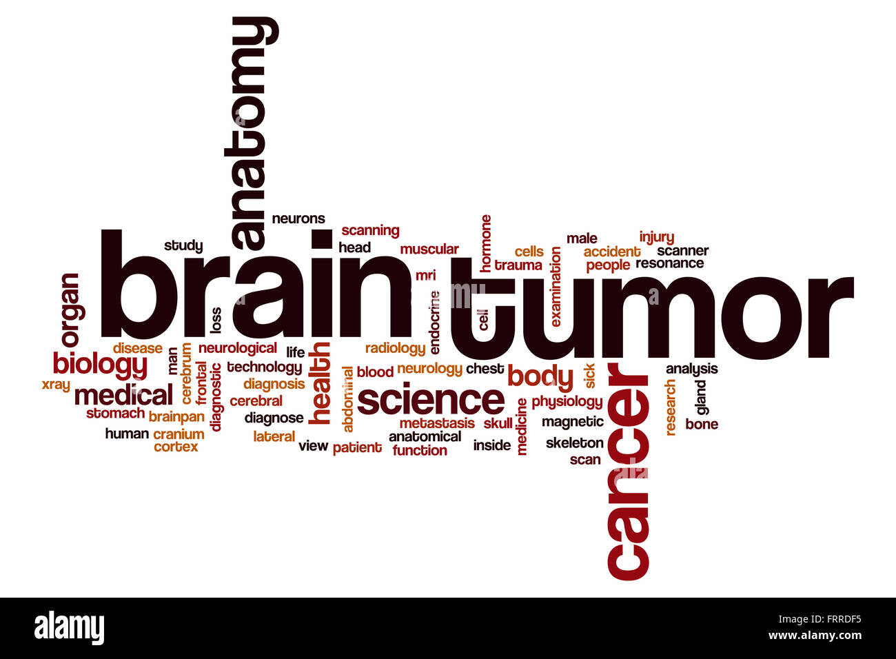 Brain tumor word cloud concept Stock Photo