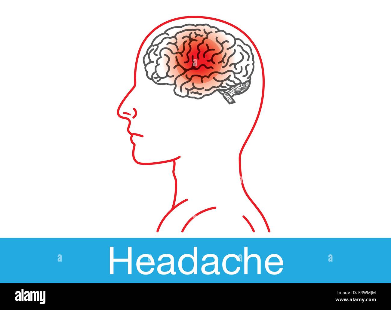 Headache signal. Stock Vector