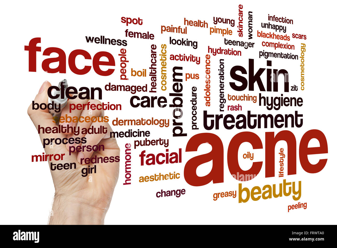 Acne word cloud concept with skin face related tags Stock Photo