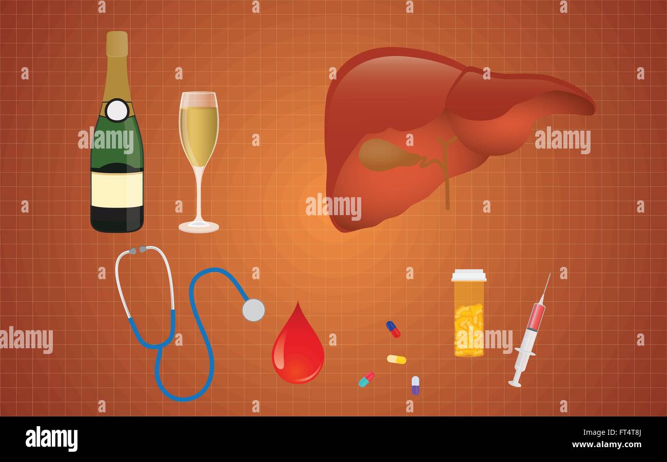 cirrhosis illustration with liver medicine alcohol as the real cause Stock Vector