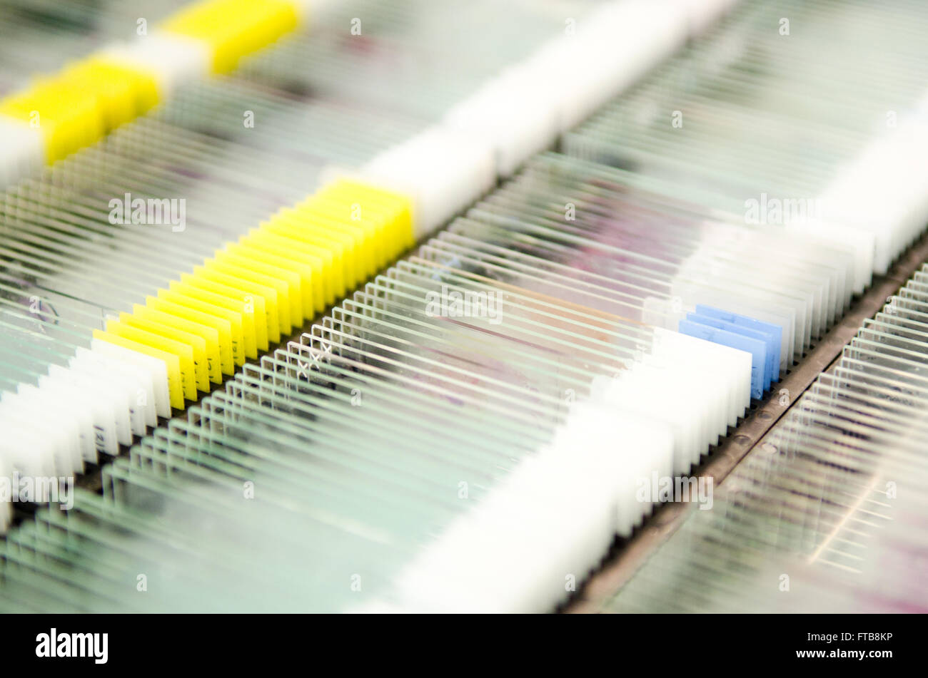 Racks of glass microscope slides containing patient or research test ...