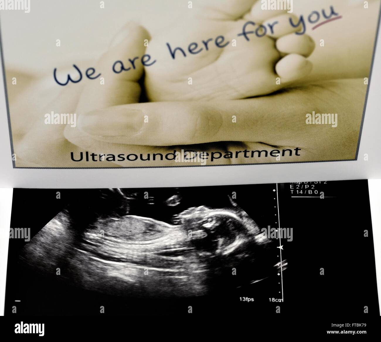 A 2nd trimester baby boy ultrasound scan Stock Photo