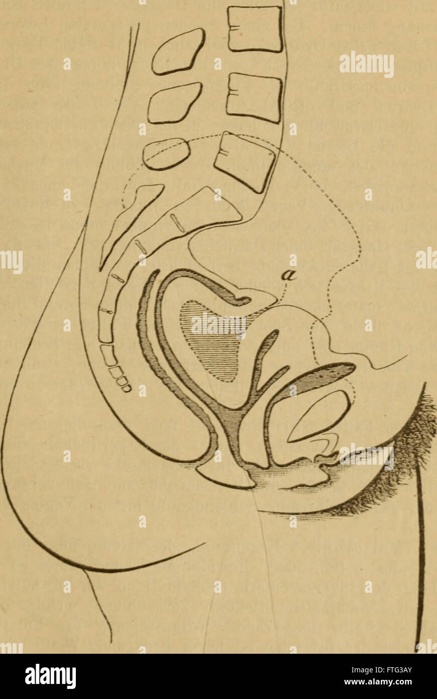 Die Pathologie und Therapie der LageverC3A4nderungen der GebC3A4rmutter (1881) Stock Photo