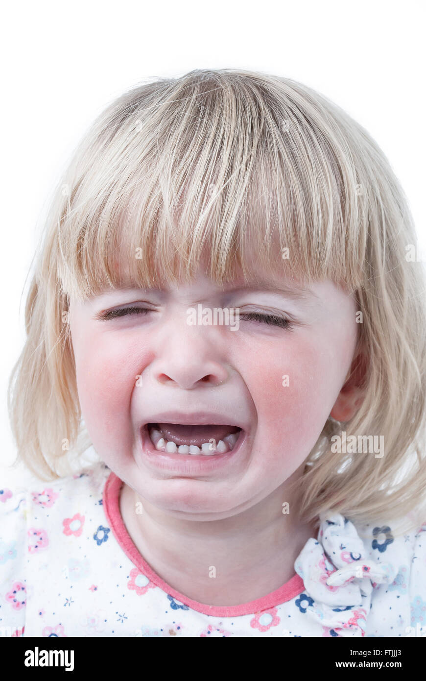 A crying teething baby girl with red swollen cheeks. Stock Photo