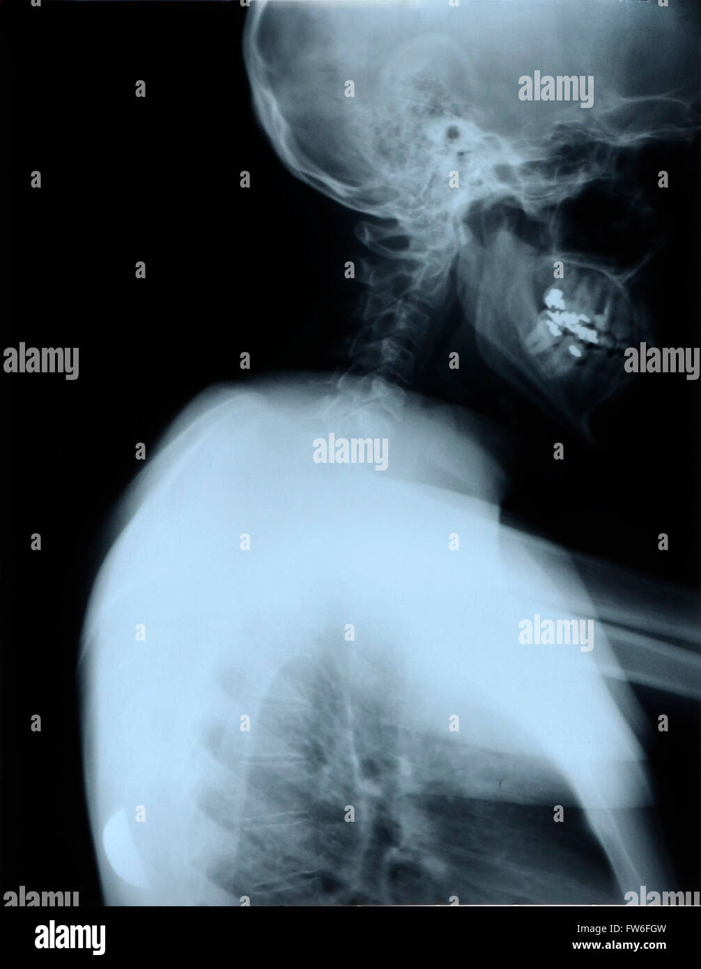 Neck face anatomy hires stock photography and images Alamy